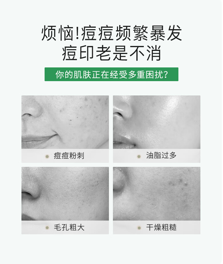 韩瑟【批发价】细致嫩肤去痘霜20g淡化痘印改善毛孔粗糙清爽润泽肌肤 韩瑟细致嫩肤去痘霜20g