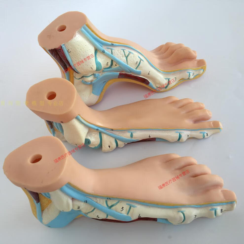 正常足 扁平足 弓型足 模型 足部病理模型人体足部肌肉解剖模型 三件