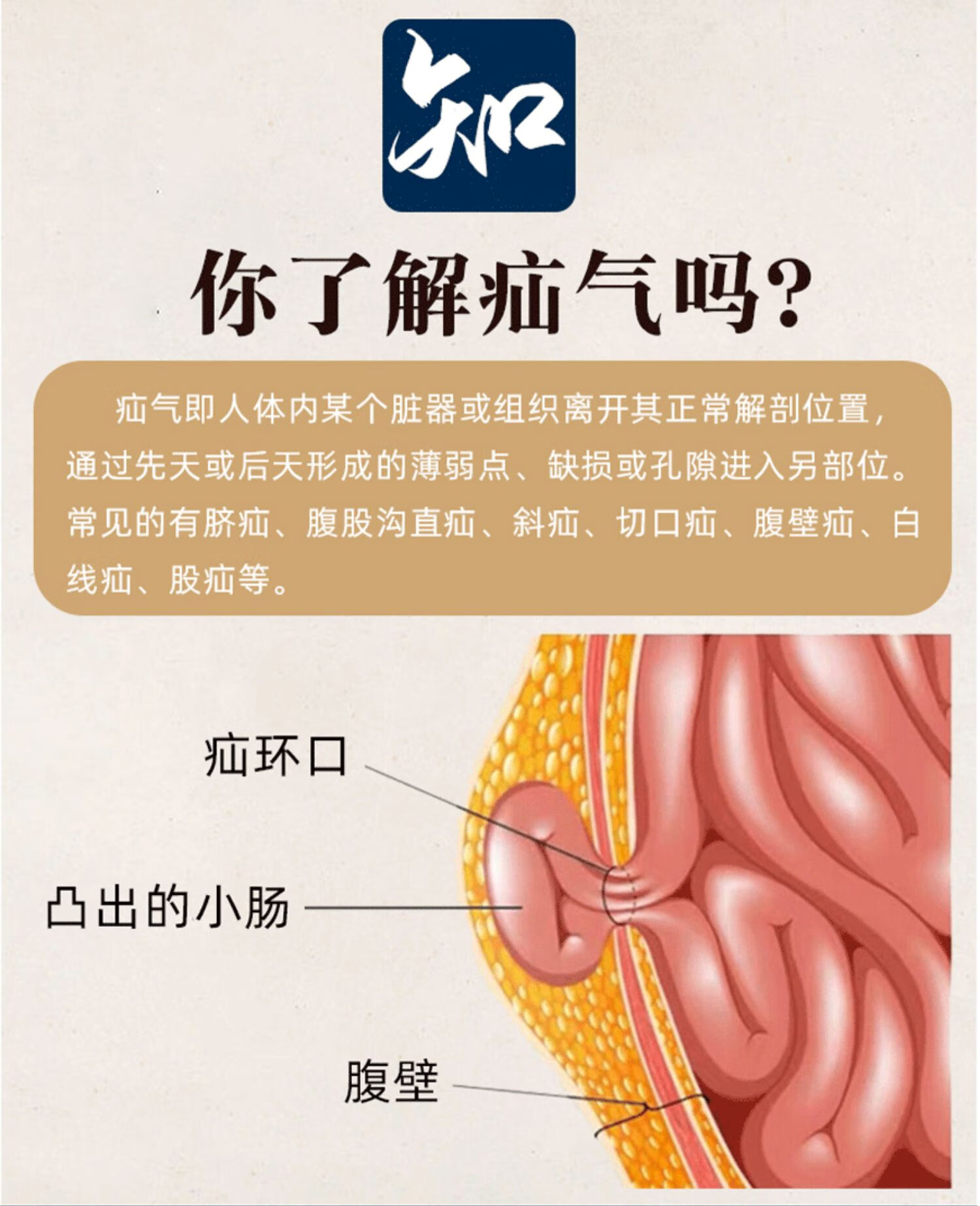 御疝冷敷貼疝氣貼老人中老年袁御疝舒冷敷貼實初男消疝腹股溝