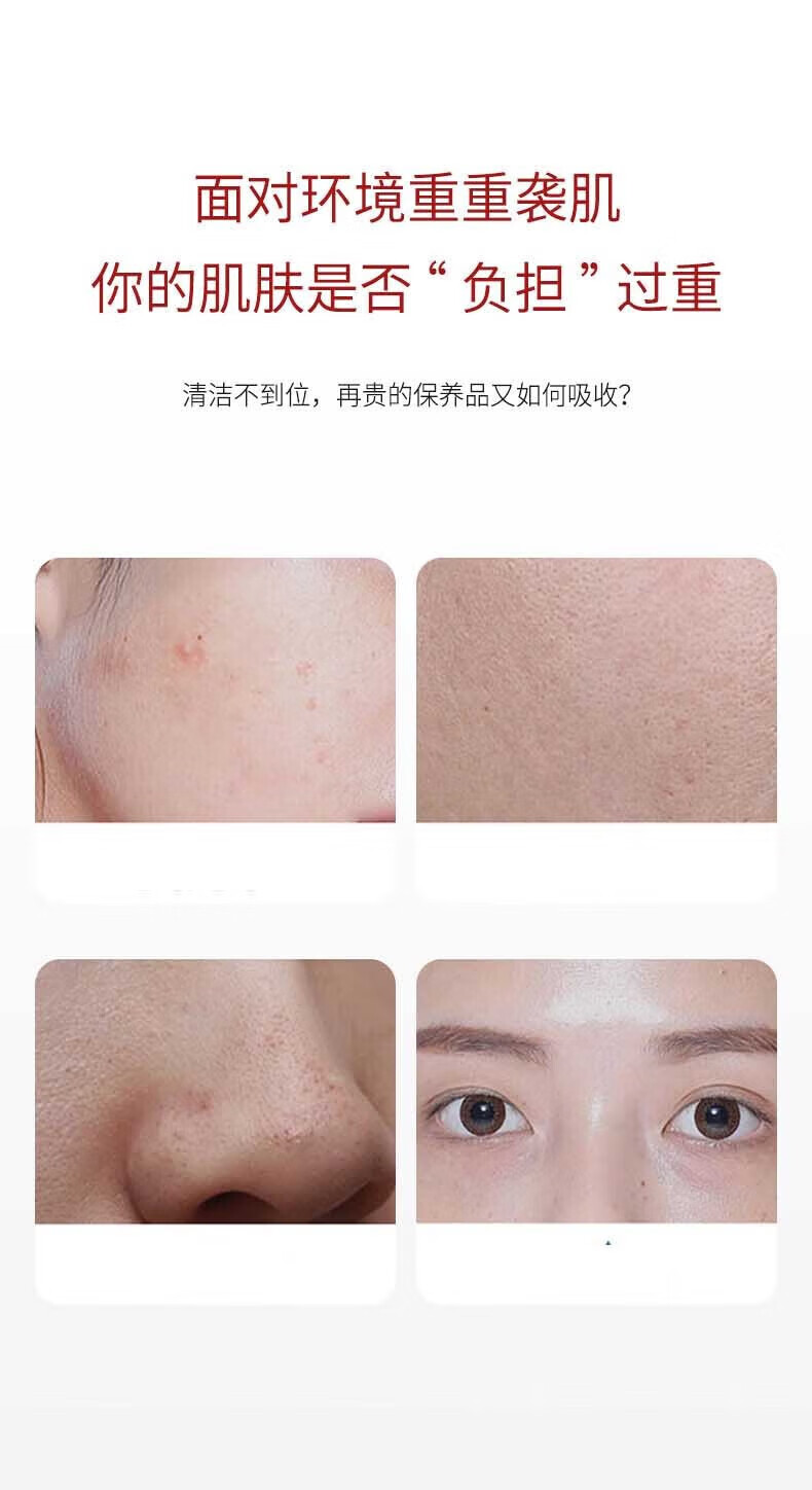 Rosetimes积雪草小气泡面膜mdb自发泡清洁毛孔面膜黑头粉刺 自发泡面膜【1支装】
