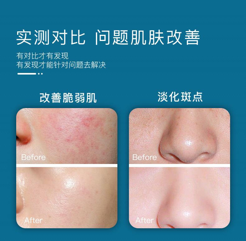 兰亭面霜原生精华冻龄霜40g