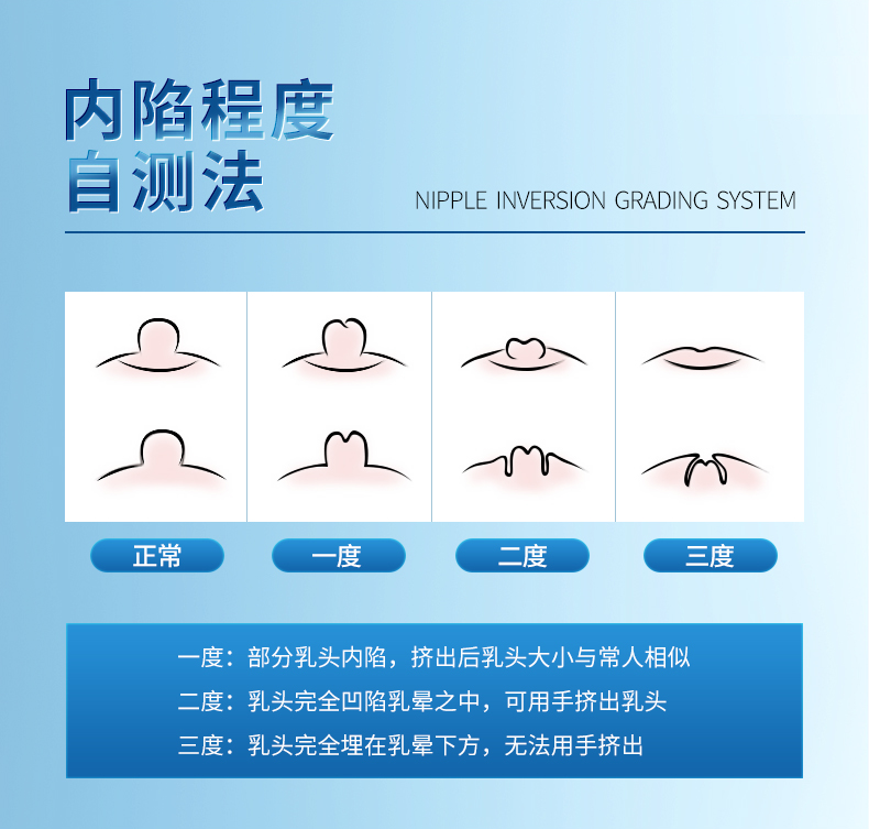 ruzhimei乳头内陷矫正器凹陷牵引纠正吸短小扁平少女孕妇学生纠正器