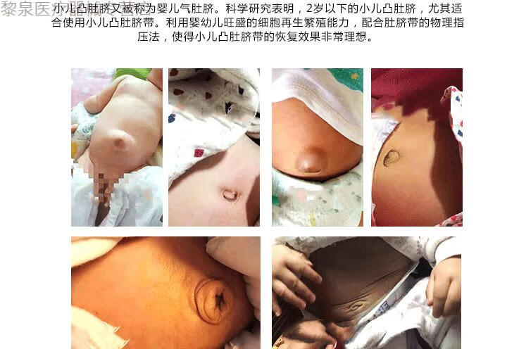 新生婴幼儿凸肚脐护脐带宝宝压肚脐鼓突出绑腹带气肚脐围贴透气疝