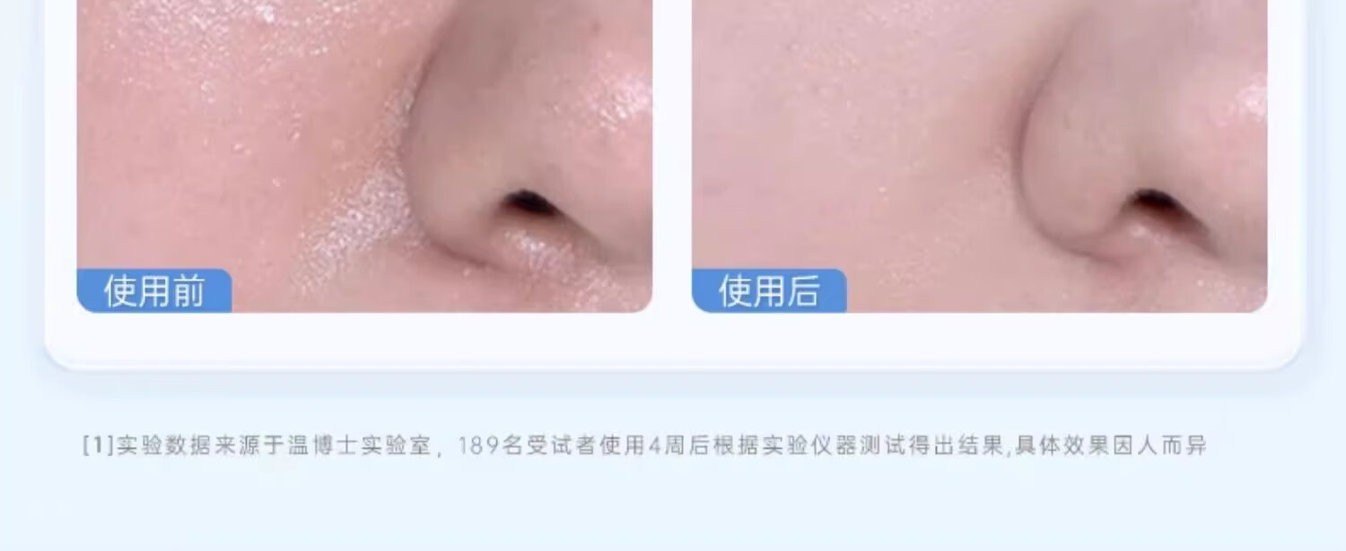 温博士维生素B5水杨酸面膜去黑头修护毛孔收缩毛孔补水保湿舒缓控油软膜 3袋装【买2送 1】控油平衡