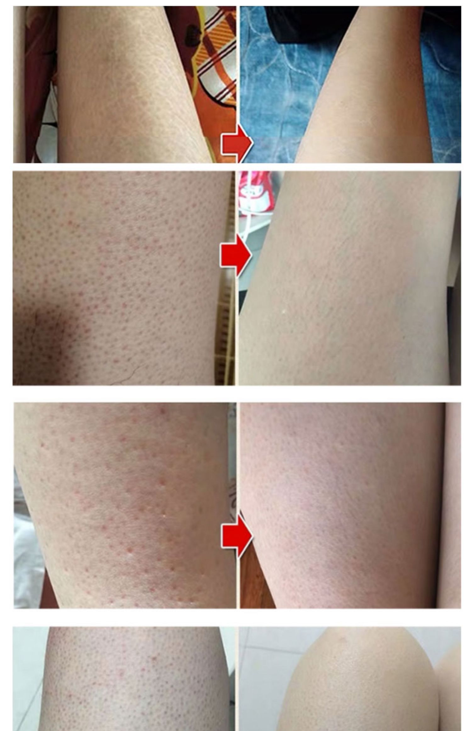 维生素a皮肤干燥去鸡皮胡萝卜素软胶囊100粒咀嚼片 口服玻尿酸 【鸡