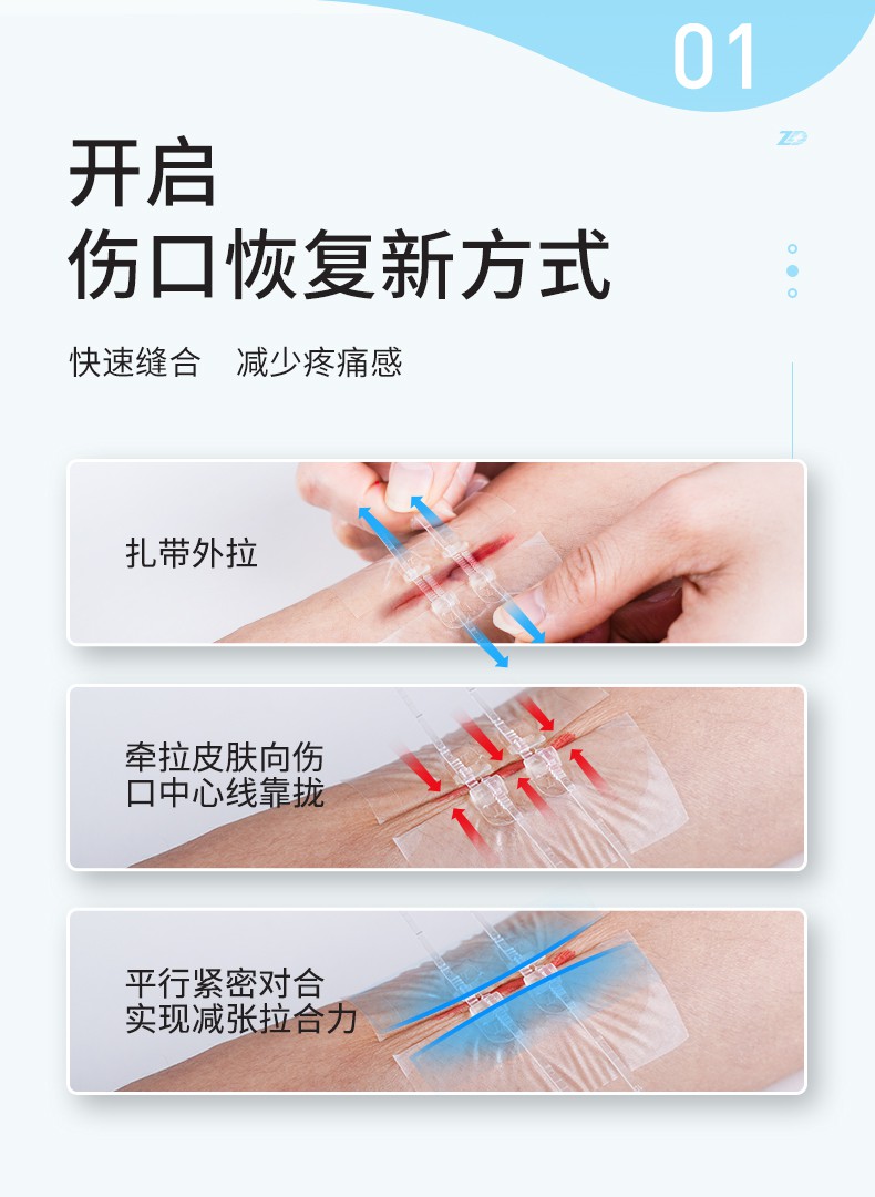 皮肤减张器疤痕减张贴伤口愈合缝合器医用免缝针拉链式创口贴 3盒(共9