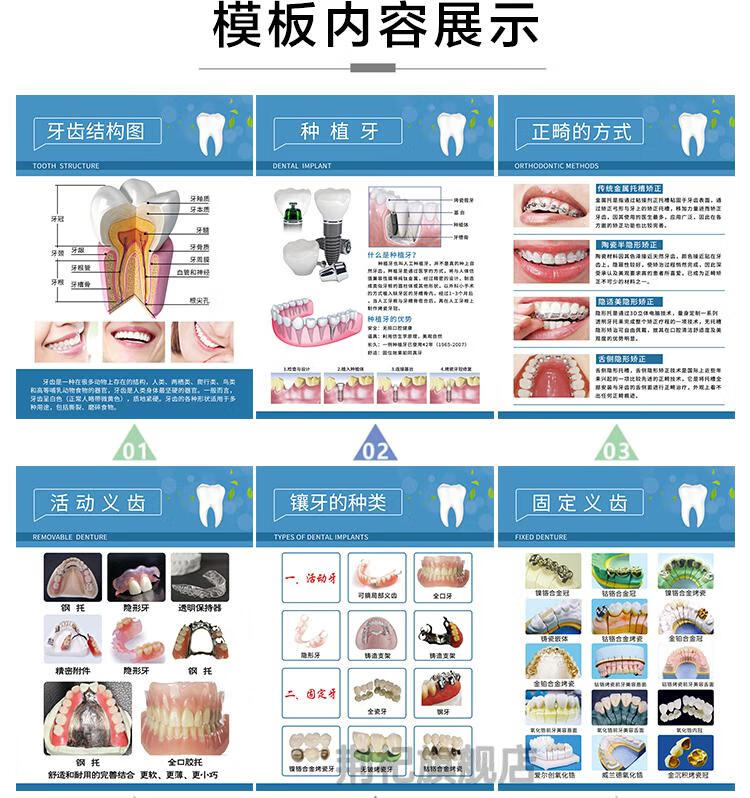 牙齒種植修復鑲牙kt板海報裝飾畫牆貼紙05鑲牙的種類50x70釐米kt板