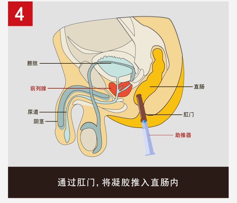 前列安栓pk野菊花栓图片