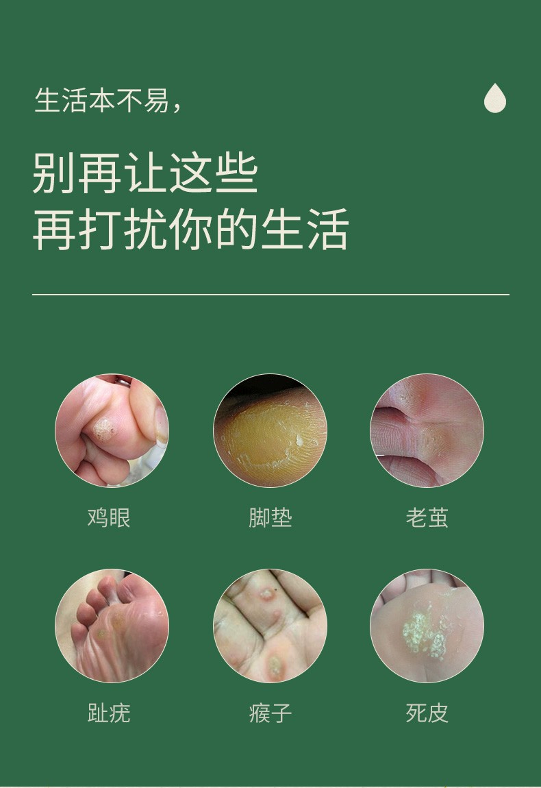 修正鸡眼贴清茧灵液消除赘生物猴子祛脚底老茧手上足部修复净疣常疣