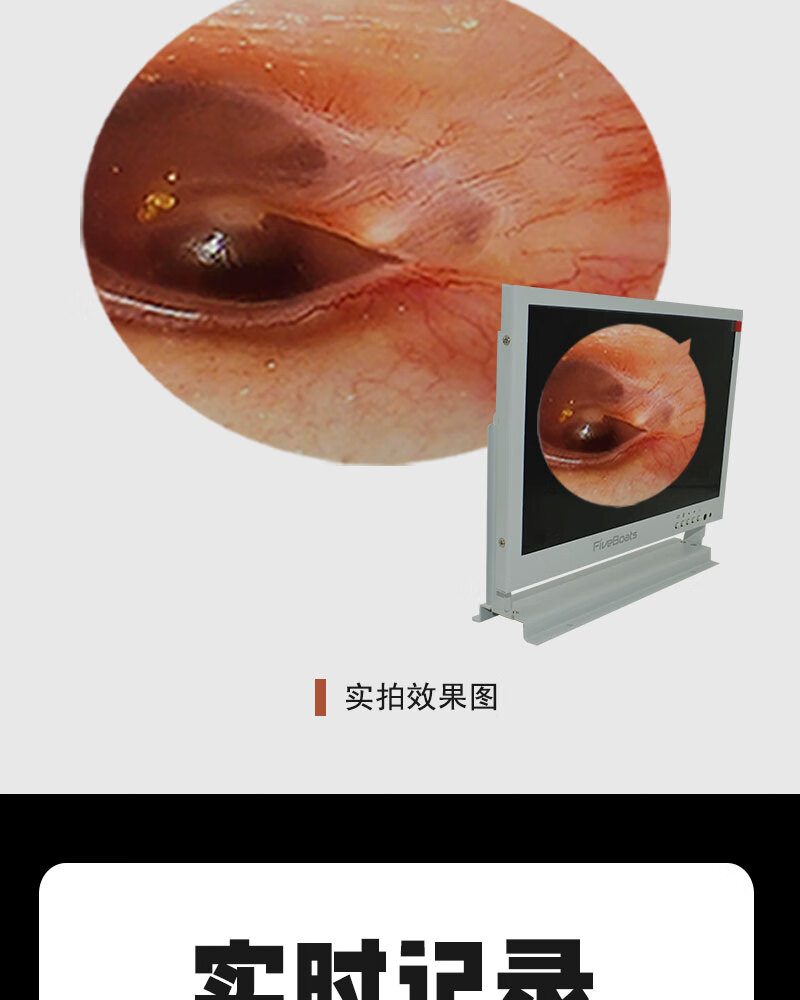 fiveboats专业高清大屏可视采耳仪器设备电子耳镜手把内窥镜内视鼻腔