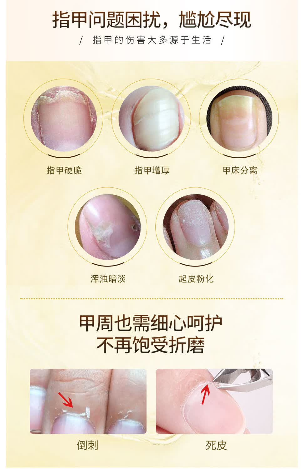 宜乐舒灰指甲特x效日本现货德国润甲油甲床分离甲空增厚油甲硬脆甲