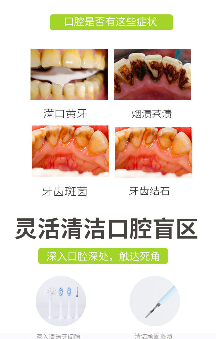 电动牙结石去除器家用超声波除牙渍牙垢清洁牙齿刷洗牙神器美白仪浅