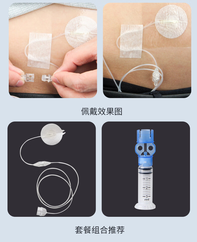 ipele艾派乐胰岛素泵耗材通配美敦力712泵722泵纽扣式可分离软针钢针