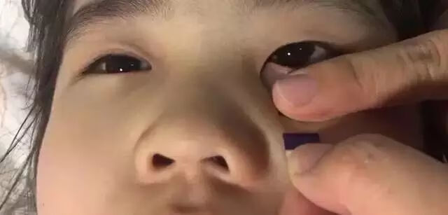 倒睫毛矫正贴倒睫毛贴睫毛夹神器儿童小孩下睫毛倒睫局部化妆师专用