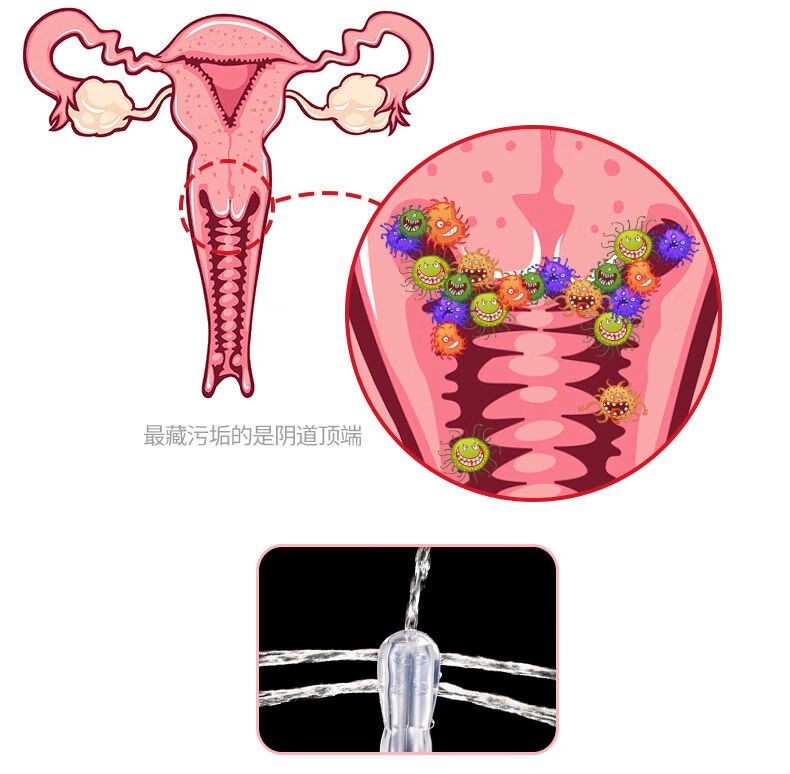 阴道冲洗器内阴大号女性妇洗器洁阴清洗器灌肠肛门屁妇科私处神器600