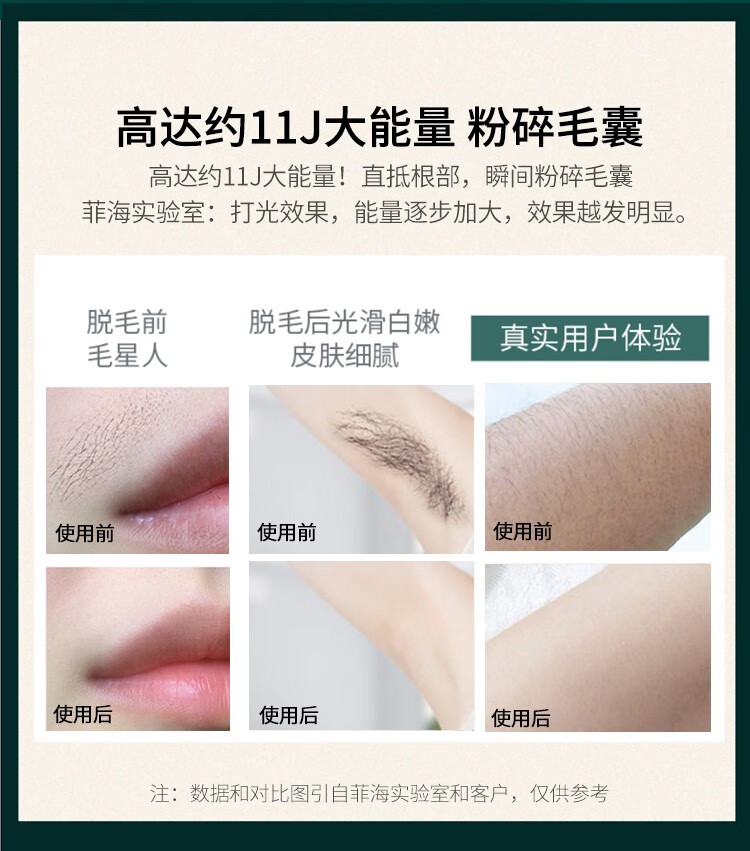 日本菲海feihai脱毛仪神器ipl冰点激光全身刮毛脱毛器仪剃毛器墨绿色 图片价格品牌报价 京东