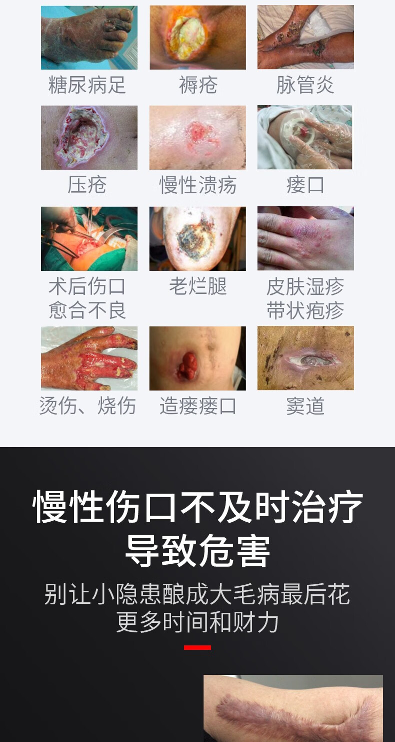 普门红光治疗仪理疗灯家用医用烤灯褥疮糖尿病足术后伤口创面愈合透析内