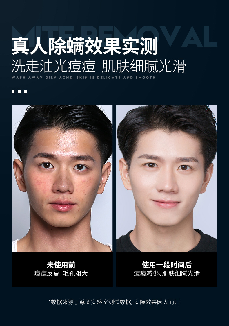 尊蓝男士控油除螨洗面奶男去黑头角质去螨虫补水保湿洁面乳护肤品套装