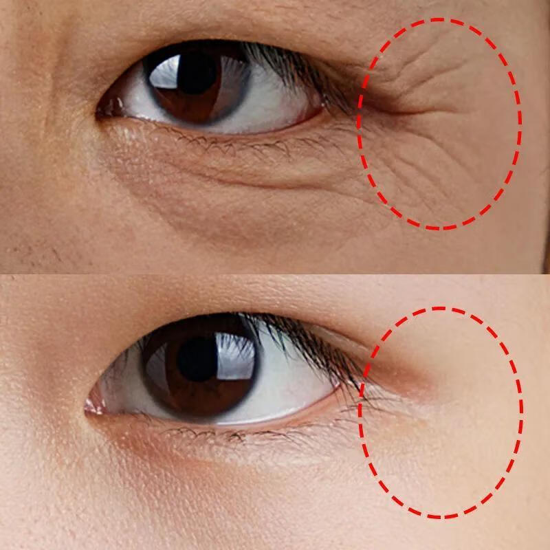 梵贞熬夜救星眼霜去黑眼圈纹眼圈去眼角纹补水男女手部眼部护理眼霜护