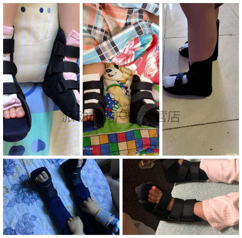 婴幼儿内八字鞋儿童足内翻足外翻马蹄足宝宝足下垂防旋鞋 xxxl码单只