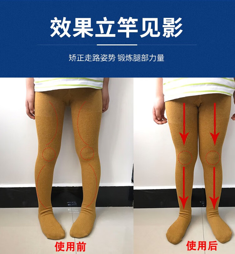 儿童内八字矫正器男女专用透气内八矫正带内旋下肢内八脚矫正神器宽腰