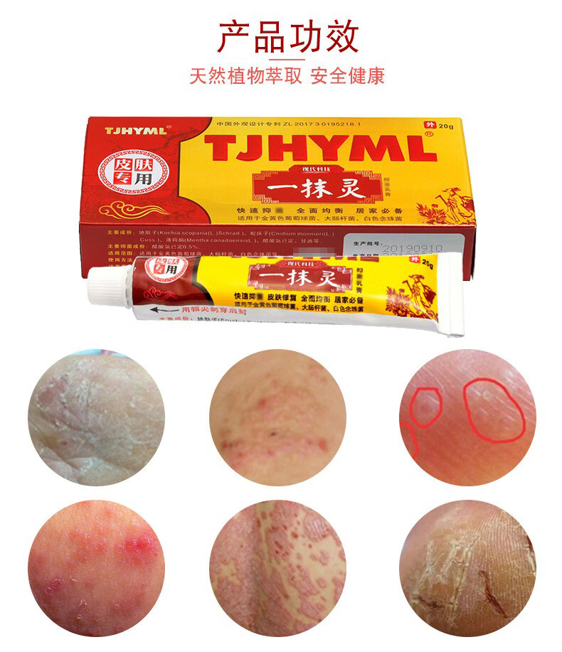 一抹灵乳膏一摸灵软膏脚气脚痒大腿内侧藓痒瘙痒皮肤止痒百消膏乙抹