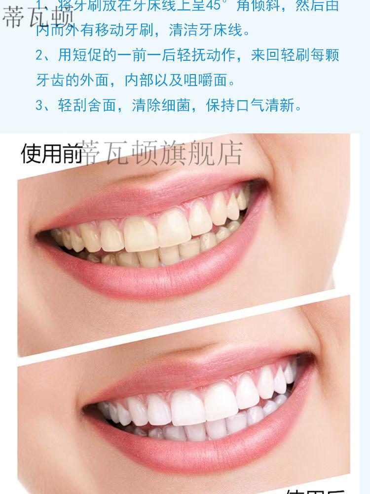 康齿灵牙膏康齿灵牙膏120g旋风白去牙渍美白牙齿清新口气1支体验旋风