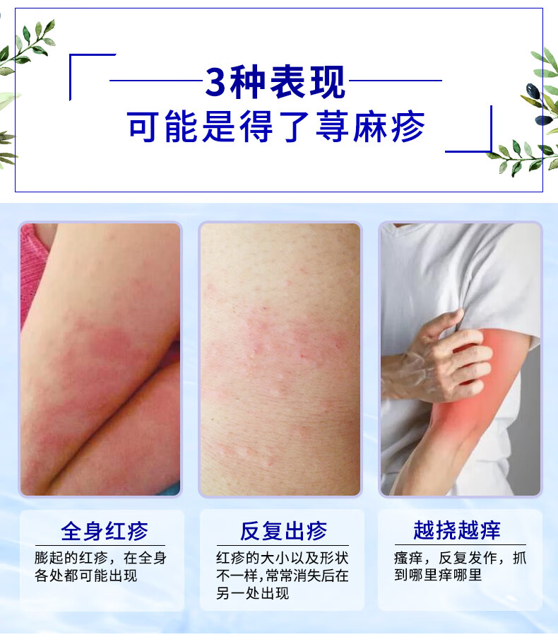 【日本小林抗过敏药】荨麻疹 红疹 接触性皮炎 鼻炎