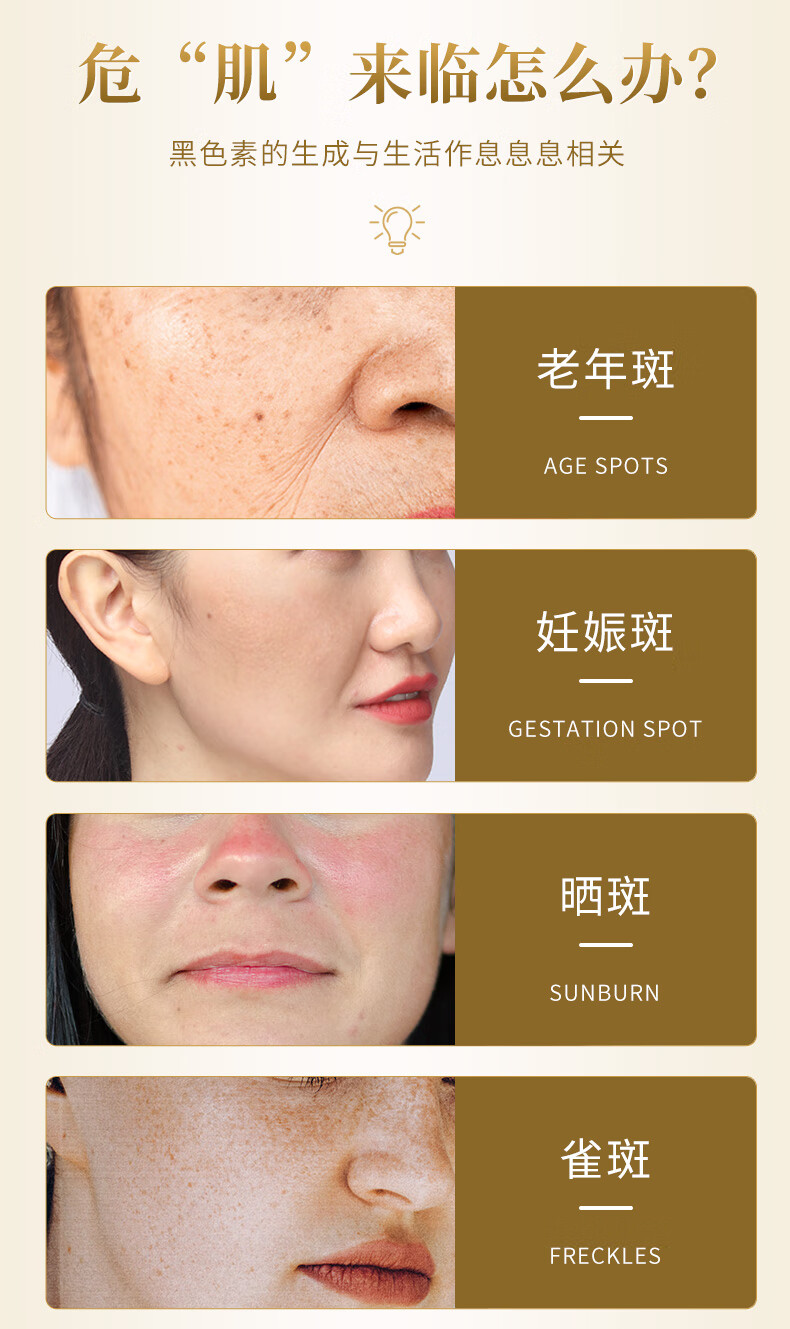 金星微美益生瑞士茜茜王妃笔霜去黑老年斑 六支【图片 价格 品牌 报价