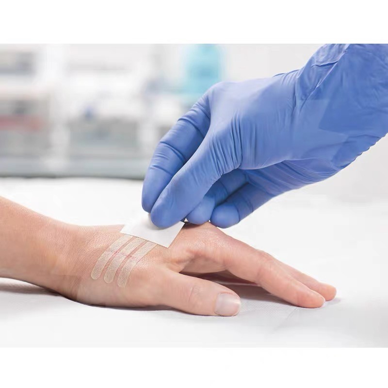 免缝胶带伤口防变宽免缝合手术修复减张贴拉合胶布 小号一盒150条(6