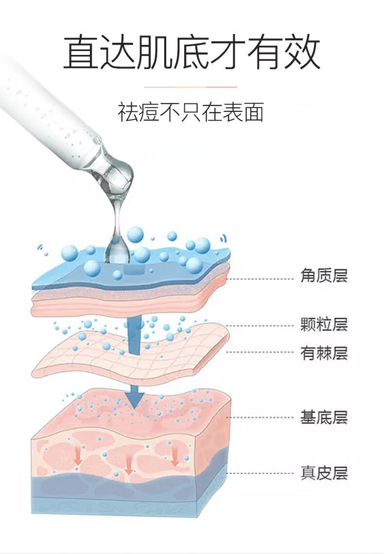 祛痘精华液去淡化痘印原液修护调理油痘肌舒缓防粉刺女精华液固态水乳