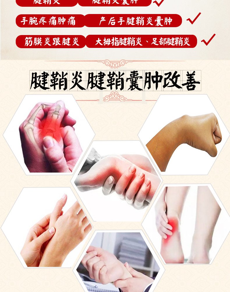腱鞘炎专用贴贴疗药nz贴痛舒贴大拇指手腕疼痛康舒筋腱鞘炎专用1盒10