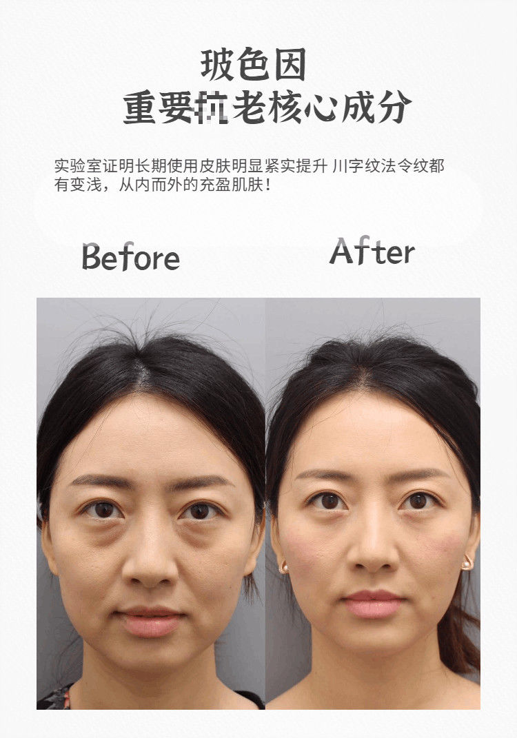 【京品优选】兰喜30%玻色因紧致原液紧致淡纹面部丰盈饱满蓝铜胜肽