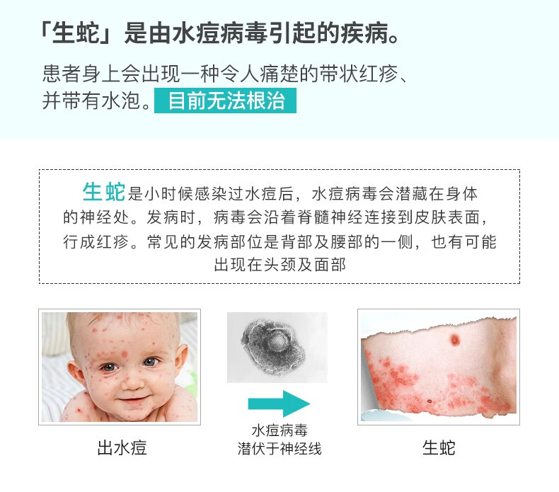 全国带状疱疹疫苗预防带状疱疹 生蛇 2次接种预约代订50岁以上适用重庆现货50岁以上男女适用 两针套餐 图片价格品牌报价 京东