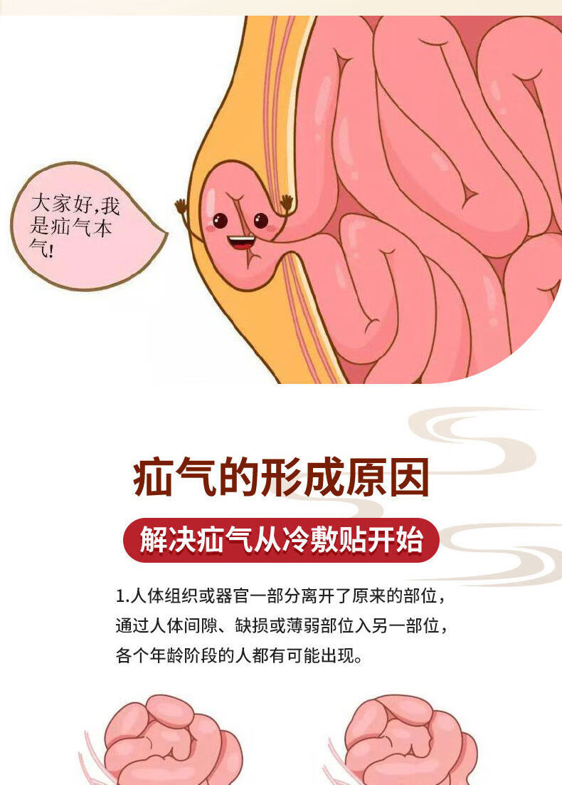 南京同仁堂疝氣貼膏臍疝老人中老年成人兒童腹股溝男女肚臍疝氣1盒裝6