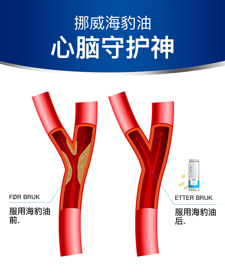 诺莱维挪威noromega海豹油软胶囊枫烯鲨酸角鲨烯保健品120粒