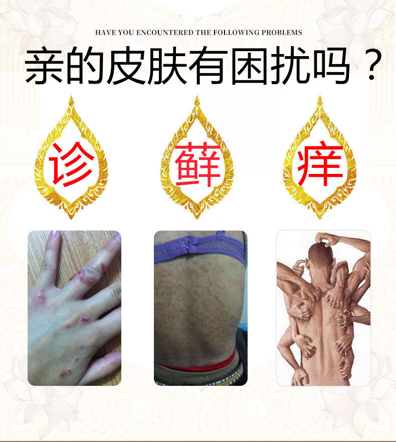 泰国配方专用皮肤瘙痒体偏方金蛇本草乳膏 6瓶装严重患者【疗程 巩固