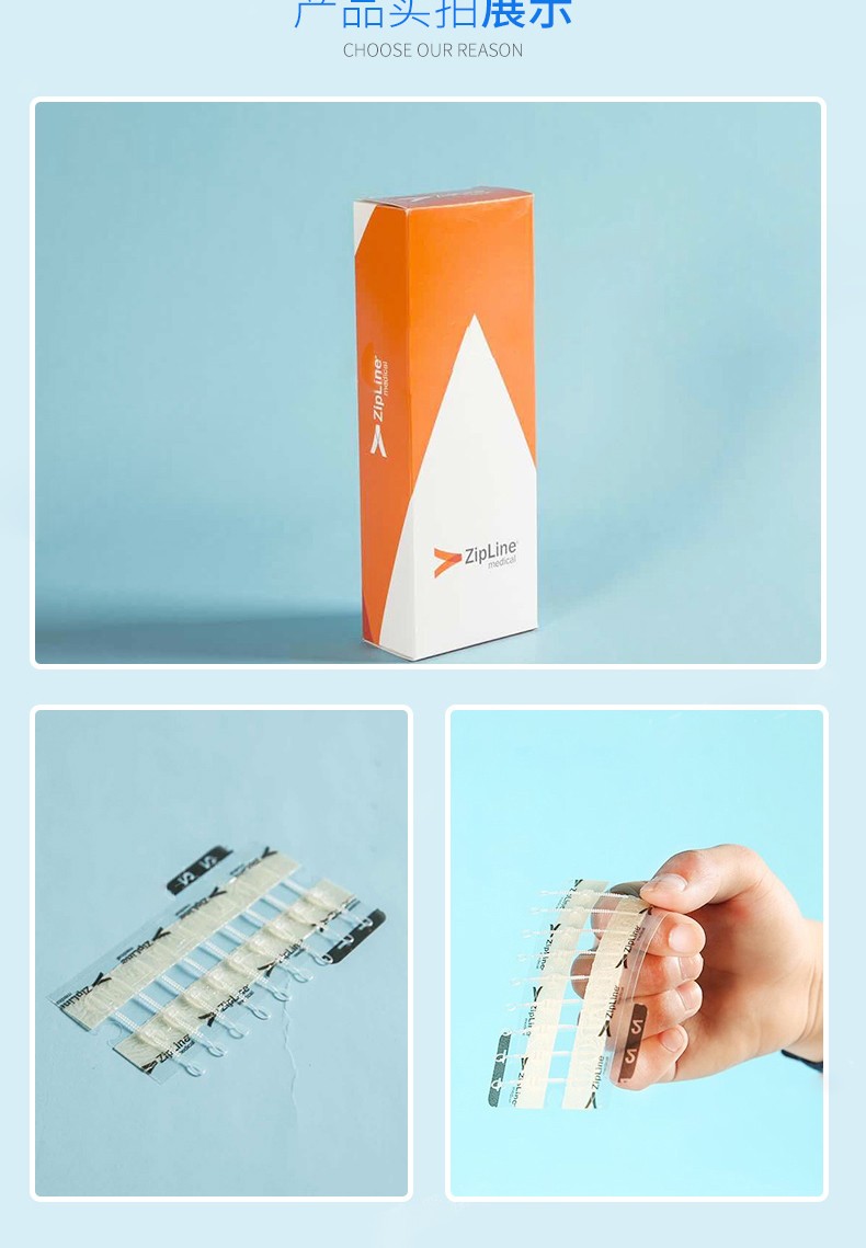 药房直售zipline减张器皮肤减张胶布胶带缝合器吻之痕剖腹产术后减