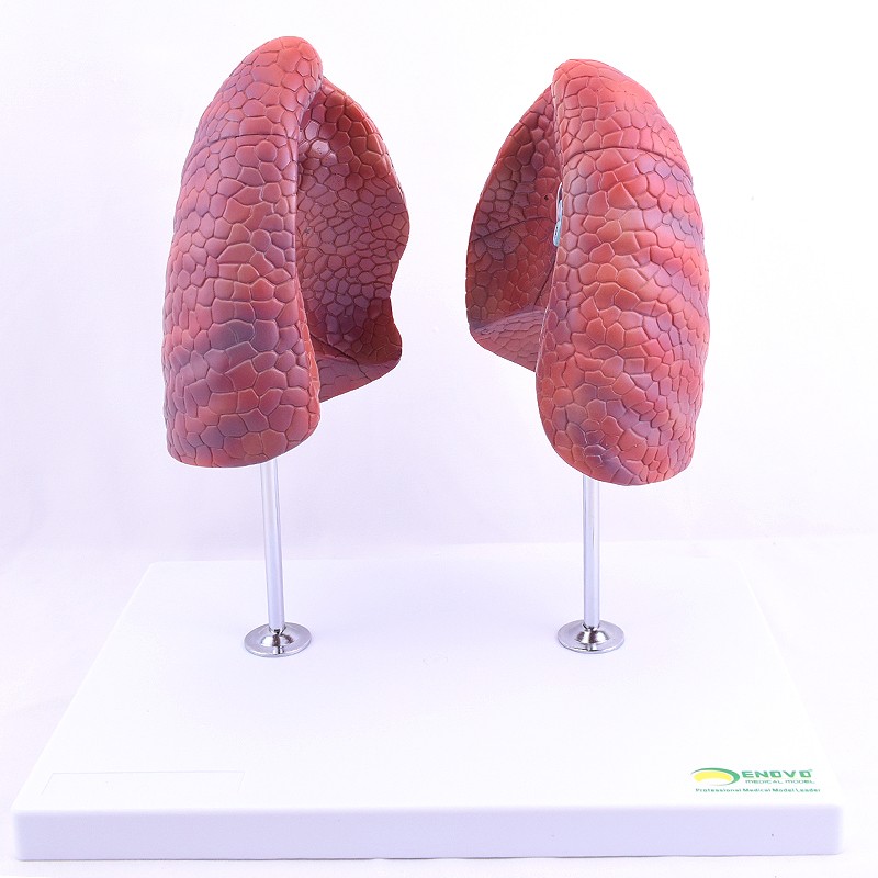 enovo颐诺医学人体肺段肺解剖模型 健康肺吸烟禁烟呼吸肺段胸外科呼吸