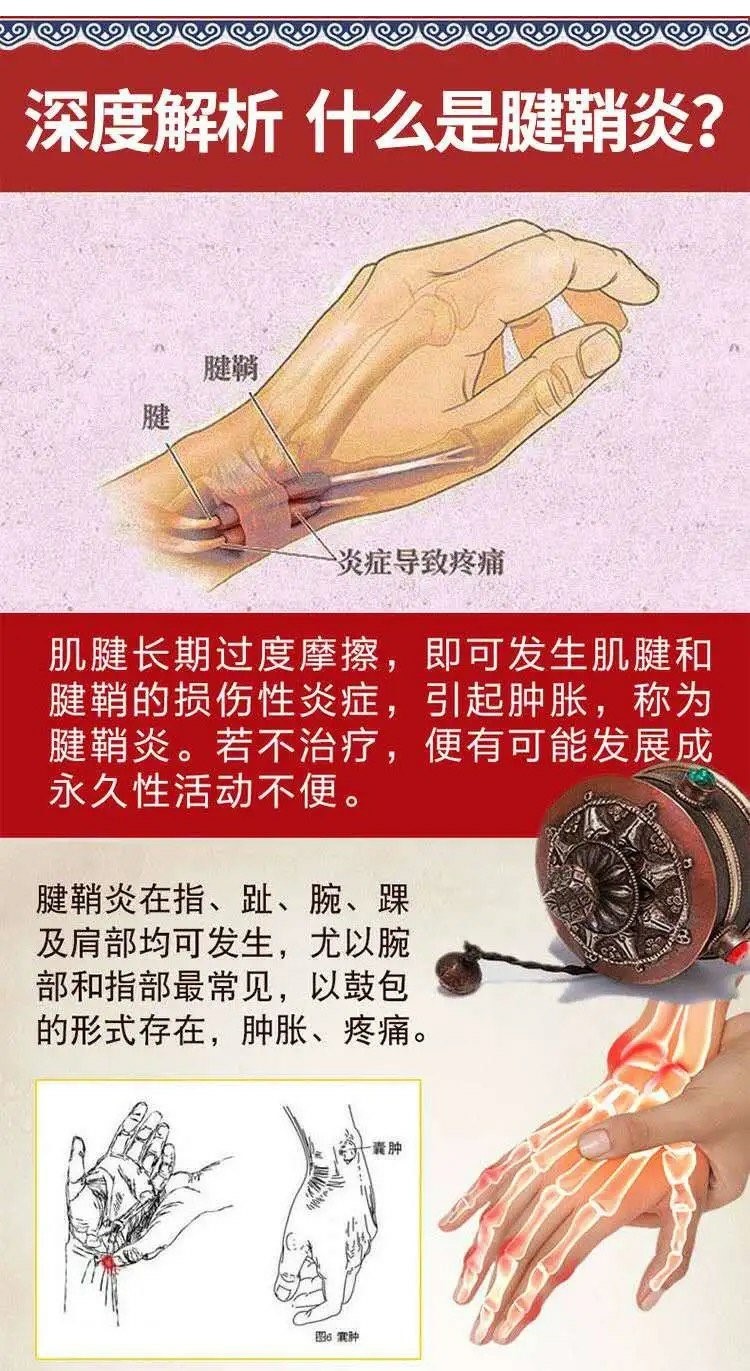 京选优品十一号腱鞘炎腱鞘囊肿手指肿胀疼痛官方本草腱逍宁11号3瓶