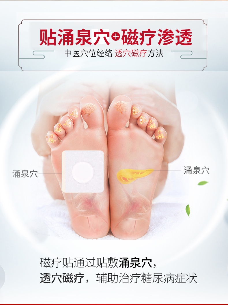 祖医堂化唐消穴位磁疗贴用于糖尿病引起症状的辅助磁疗贴敷足底涌泉穴