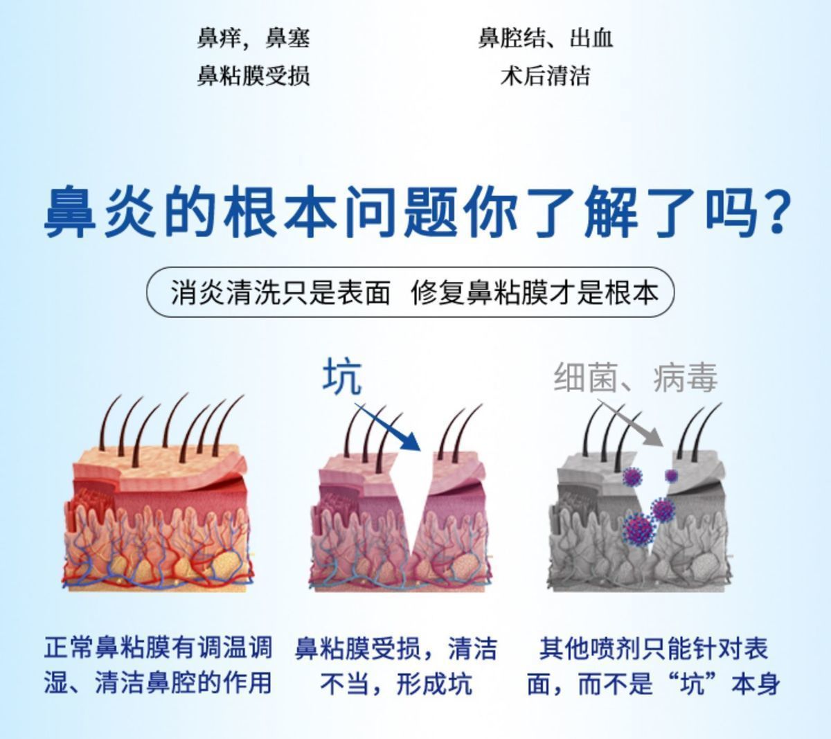 鼻敏灵鼻腔喷雾器作用图片