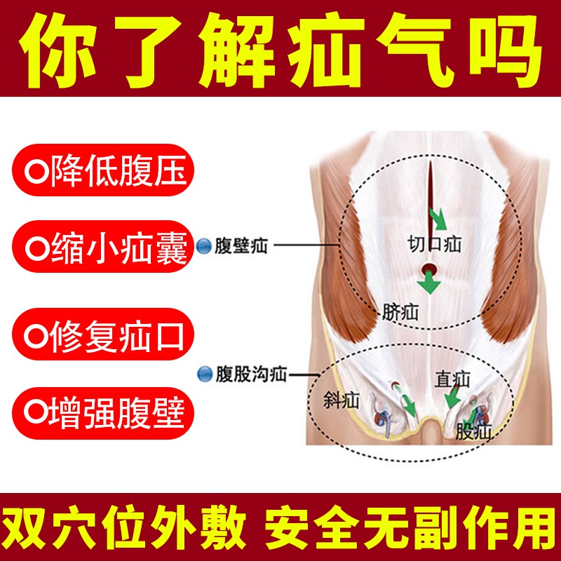 疝氣貼藥膏中老年嬰兒腹股溝肚臍疝貼男性疝氣帶小腸氣消疝臍疝貼