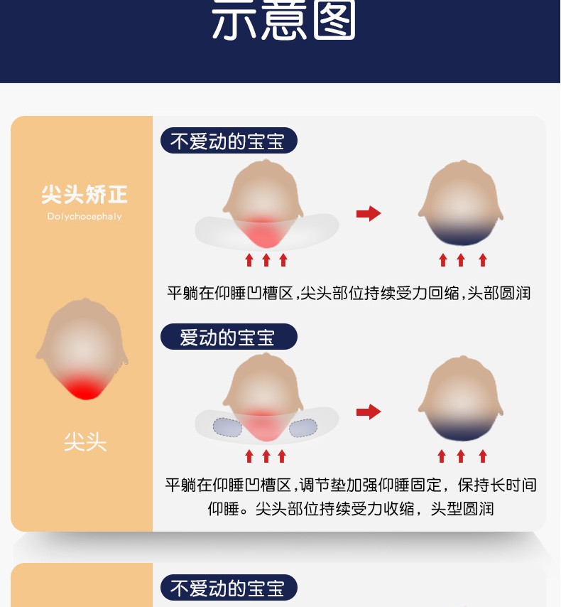 贝贝艾婴儿定型枕防偏头宝宝枕头01岁新生儿纠正扁头尖头幼儿矫正头型