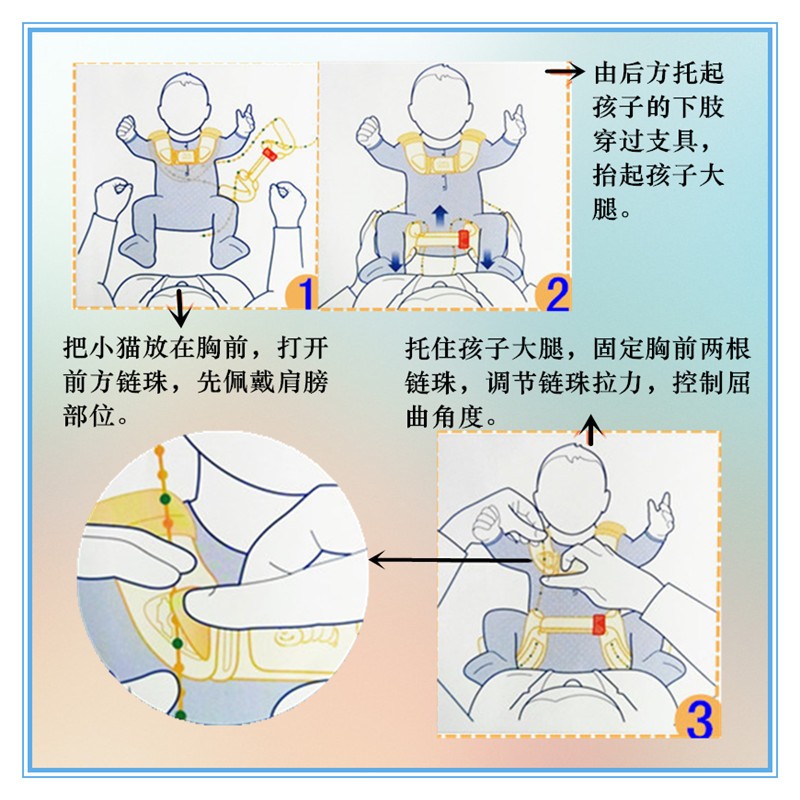 髋关节矫形器婴儿髋发育不良吊带式外展支具儿童蛙式支架宝宝护具肩套