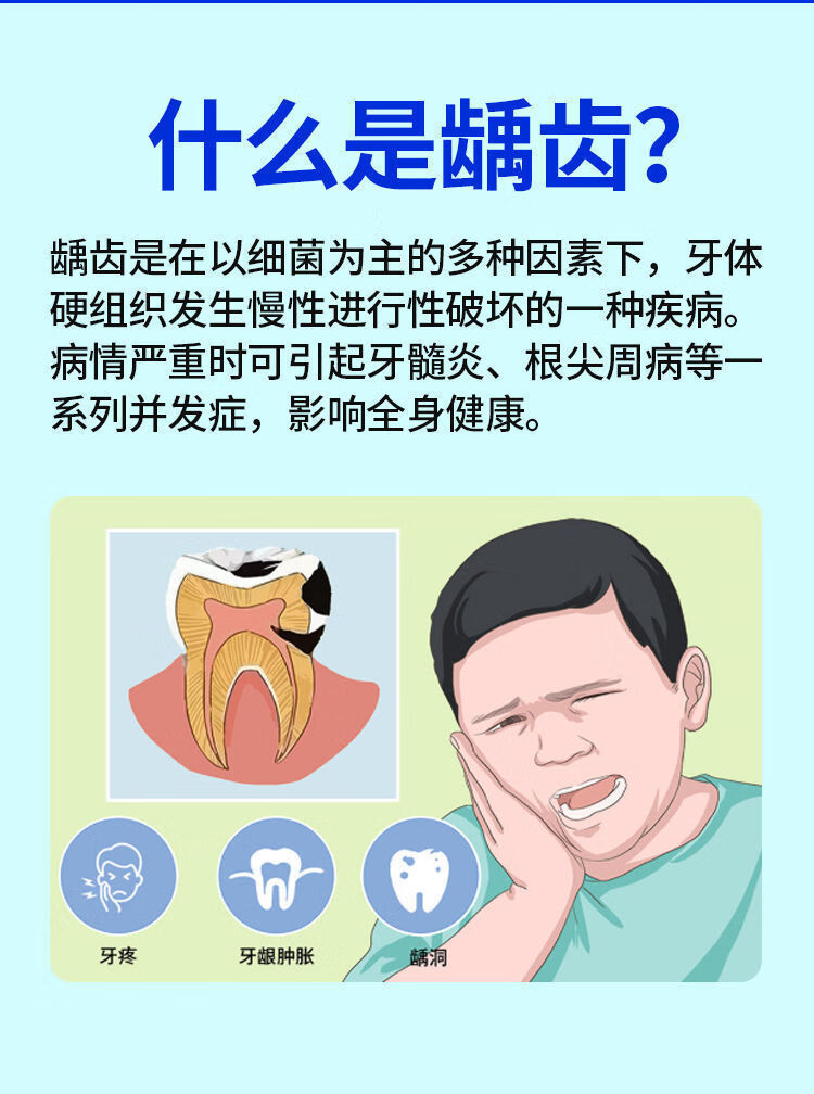 官方旗艦補牙洞材料自己補牙快速修復蛀牙修黑斑大人兒童蟲牙菌斑牙齦