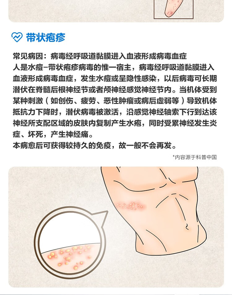 仁和 阿昔洛韦乳膏 15g 治疗单纯疱疹 带状疱疹 感染软膏zf 单盒装