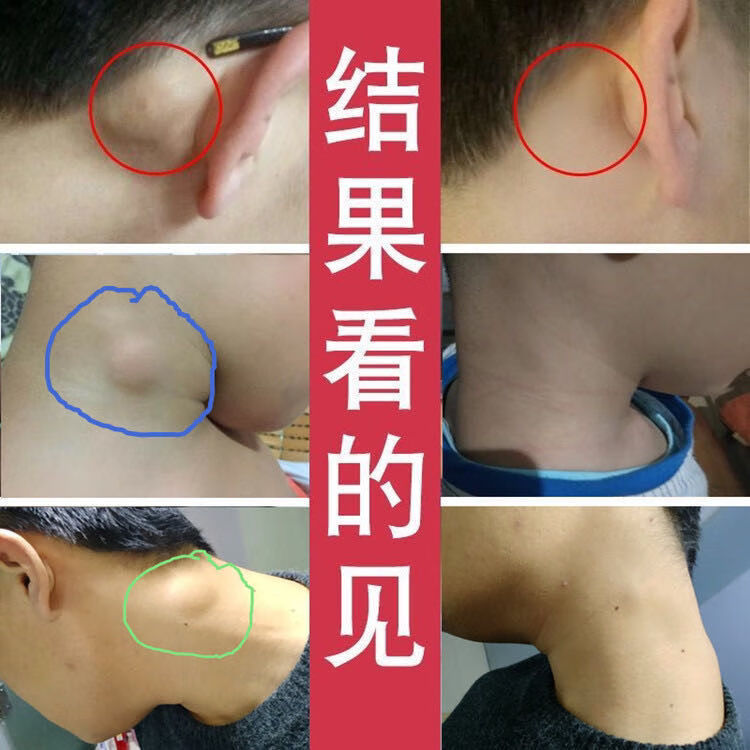 三大丽趣庆唐 庆唐淋巴贴 三木丽趣庆唐 红日一号 红叶 qt 二盒装