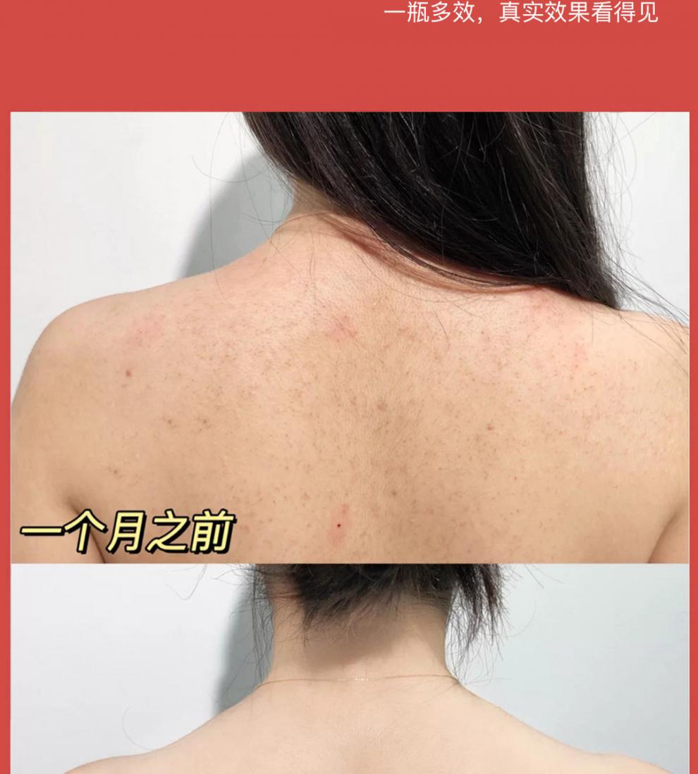 身体乳去鸡皮疙瘩全身磨砂膏提亮肌肤果酸补水鱼鳞去角质 750ml两瓶装