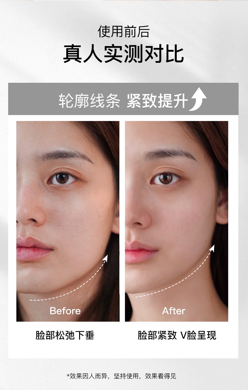 ilift多功能瘦脸神器家用脸部滚轮按摩器手动面部ems微电流提拉紧致